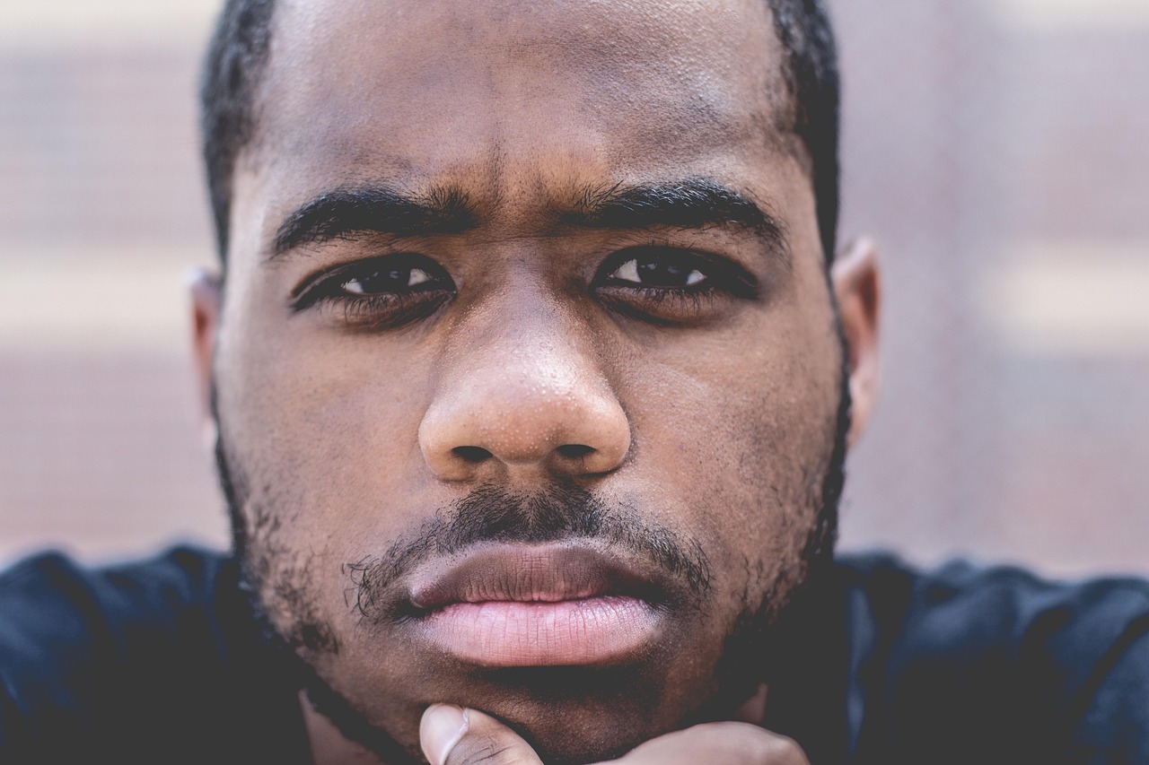 NF宝贝(国际)生殖的婴儿额头上有白色斑点(NF宝贝(国际)生殖的婴儿额头上白点一样的小疙瘩) NF宝贝(国际)生殖的婴儿额头上有白色斑点(NF宝贝(国际)生殖的婴儿额头上白点一样的小疙瘩)